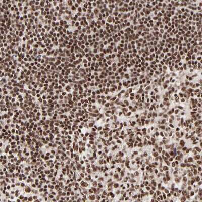 Immunohistochemistry-Paraffin: RBM22 Antibody [NBP1-85379]
