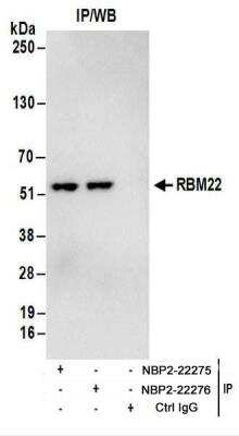 Immunoprecipitation: RBM22 Antibody [NBP2-22275]