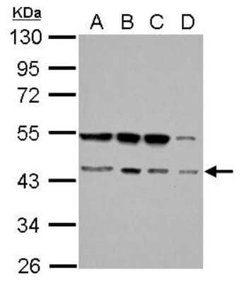 Western Blot: RBM22 Antibody [NBP2-20104]