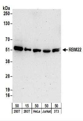 Western Blot: RBM22 Antibody [NBP2-22275]