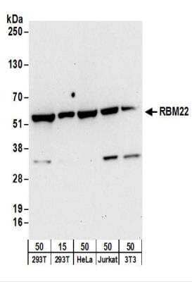 Western Blot: RBM22 Antibody [NBP2-22276]