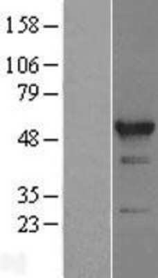 Western Blot: RBM22 Overexpression Lysate [NBL1-15200]