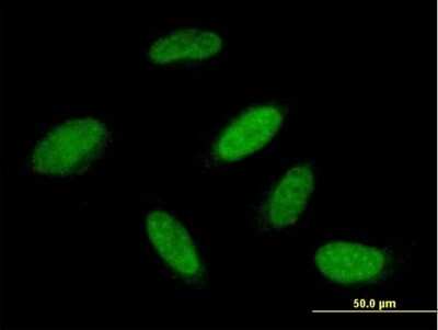 Immunocytochemistry/ Immunofluorescence: RBM23 Antibody [H00055147-B01P]