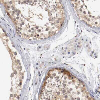 Immunohistochemistry-Paraffin: RBM23 Antibody [NBP1-83857]