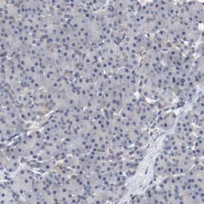 Immunohistochemistry-Paraffin: RBM23 Antibody [NBP1-83857]