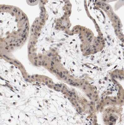 Immunohistochemistry-Paraffin: RBM23 Antibody [NBP1-83857]