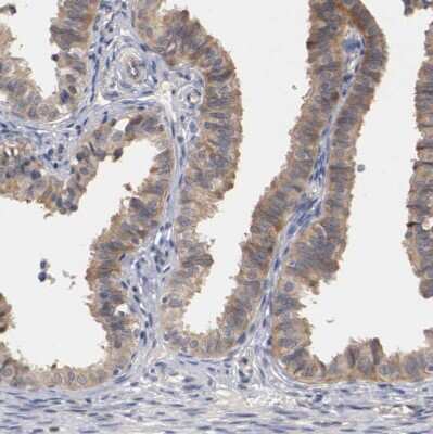 Immunohistochemistry-Paraffin: RBM23 Antibody [NBP1-83857]