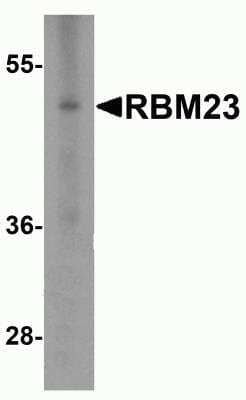 Western Blot: RBM23 AntibodyBSA Free [NBP2-81986]