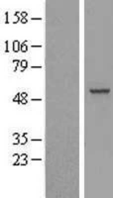 Western Blot: RBM23 Overexpression Lysate [NBL1-15201]