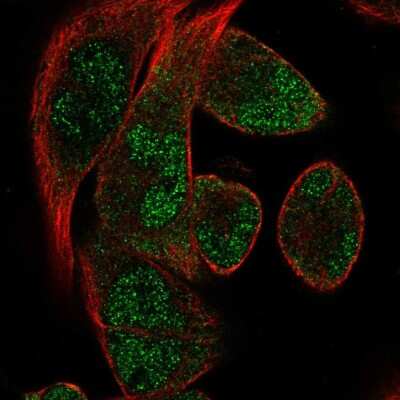 Immunocytochemistry/ Immunofluorescence: RBM24 Antibody [NBP2-56266]