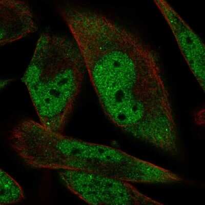 Immunocytochemistry/ Immunofluorescence: RBM24 Antibody [NBP2-57328]