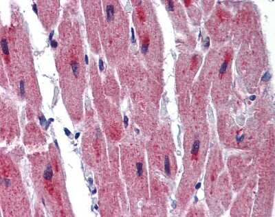 Immunohistochemistry-Paraffin: RBM24 Antibody [NBP1-80482]