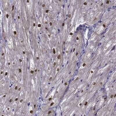 Immunohistochemistry-Paraffin: RBM24 Antibody [NBP2-57328]
