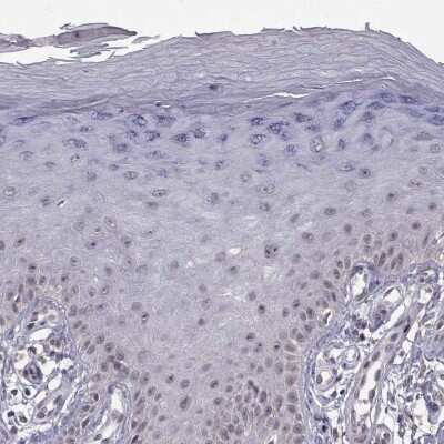 Immunohistochemistry-Paraffin: RBM24 Antibody [NBP2-57328]