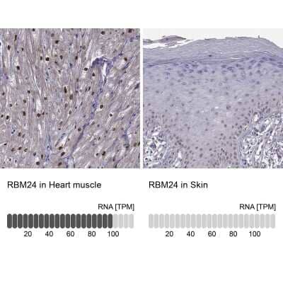 Immunohistochemistry-Paraffin: RBM24 Antibody [NBP2-57328]