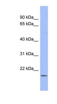 Western Blot: RBM24 Antibody [NBP1-80482]