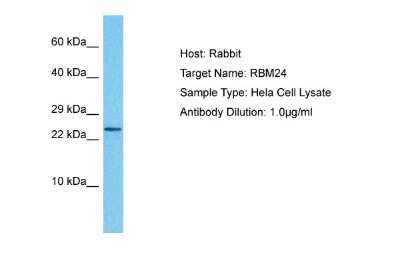 Western Blot: RBM24 Antibody [NBP1-80482]
