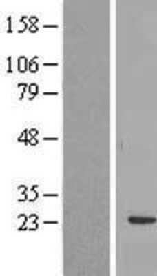 Western Blot: RBM24 Overexpression Lysate [NBL1-15202]