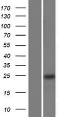 Western Blot: RBM24 Overexpression Lysate [NBP2-09699]