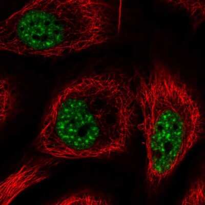 Immunocytochemistry/ Immunofluorescence: RBM25 Antibody [NBP2-57656]