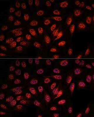 Immunocytochemistry/ Immunofluorescence: RBM25 Antibody - Azide and BSA Free [NBP2-93951]