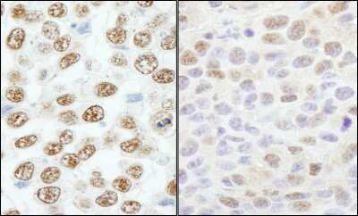Immunohistochemistry-Paraffin: RBM25 Antibody [NB100-57506]
