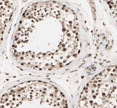 Immunohistochemistry-Paraffin: RBM25 Antibody [NBP1-83418]