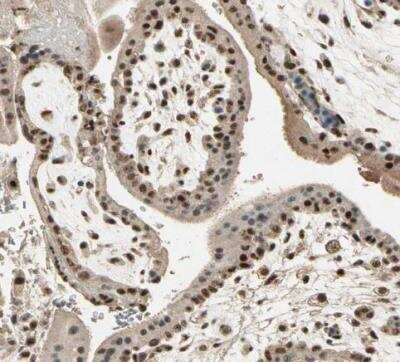 Immunohistochemistry-Paraffin: RBM25 Antibody [NBP1-83418]