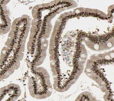 Immunohistochemistry-Paraffin: RBM25 Antibody [NBP1-83418]