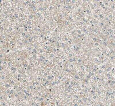 Immunohistochemistry-Paraffin: RBM25 Antibody [NBP1-83418]