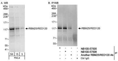 Western Blot: RBM25 Antibody [NB100-57505]