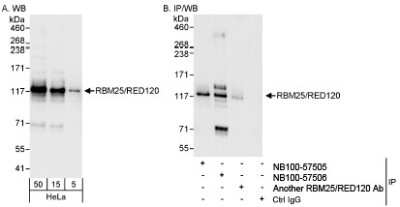 Western Blot: RBM25 Antibody [NB100-57506]