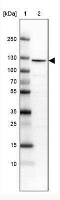 Western Blot: RBM25 Antibody [NBP1-83418]