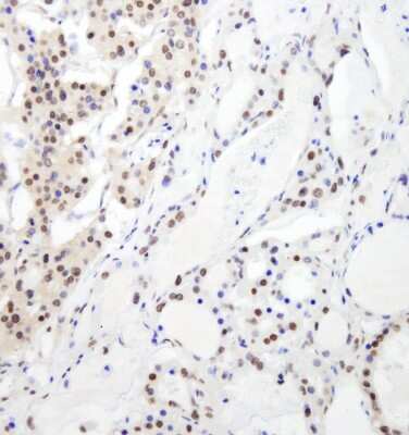 Immunohistochemistry: RBM26 Antibody [NB100-60408]