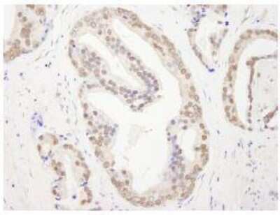 Immunohistochemistry-Paraffin: RBM26 Antibody [NB100-60408]