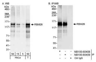 Western Blot: RBM26 Antibody [NB100-60408]