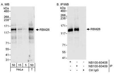 Western Blot: RBM26 Antibody [NB100-60409]