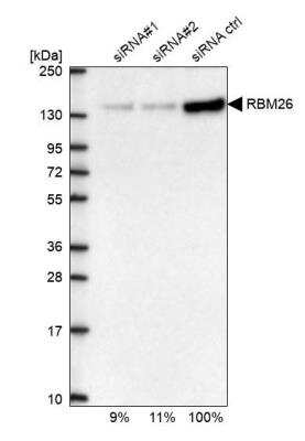 Western Blot: RBM26 Antibody [NBP1-89007]