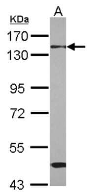 Western Blot: RBM26 Antibody [NBP2-20105]