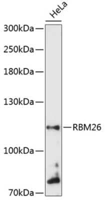 Western Blot: RBM26 AntibodyAzide and BSA Free [NBP2-94368]