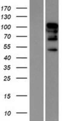 Western Blot: RBM26 Overexpression Lysate [NBP2-06472]