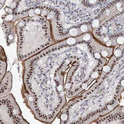 Immunohistochemistry-Paraffin: RBM27 Antibody [NBP1-90817]