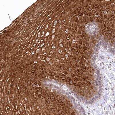 Immunohistochemistry-Paraffin: RBM27 Antibody [NBP1-90818]