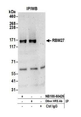 Immunoprecipitation: RBM27 Antibody [NB100-60426]