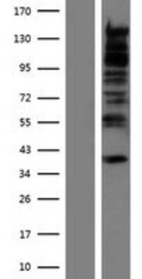 Western Blot: RBM27 Overexpression Lysate [NBP2-09891]