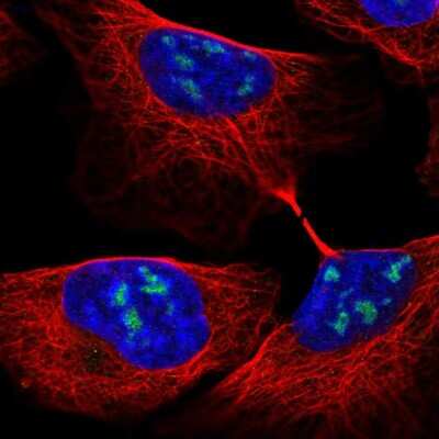 Immunocytochemistry/ Immunofluorescence: RBM28 Antibody [NBP2-54998]