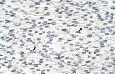 Immunohistochemistry-Paraffin: RBM28 Antibody [NBP1-57228]