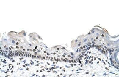Immunohistochemistry-Paraffin: RBM28 Antibody [NBP1-57228]