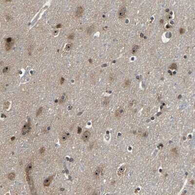 Immunohistochemistry-Paraffin: RBM28 Antibody [NBP1-84632]