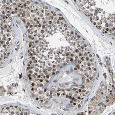 Immunohistochemistry-Paraffin: RBM28 Antibody [NBP1-84632]